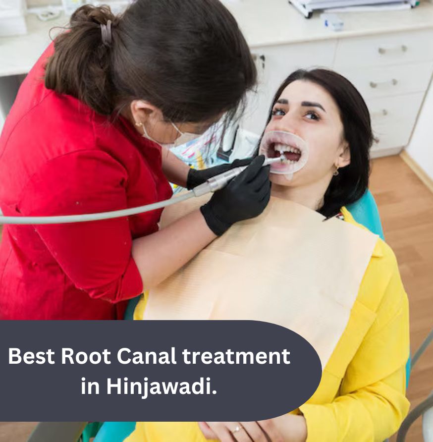 Understanding Root Canal Treatment in Hinjawadi What to Expect | DrSarikaShelke